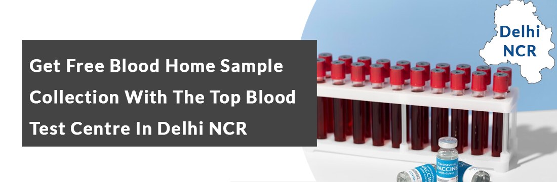 Get Free Blood Home Sample Collection With the Top Blood Test Centre in Delhi NCR